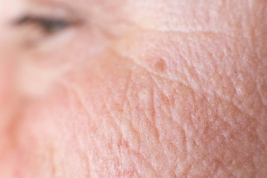 age spots on the face of a woman with dry skin and wrinkles, background, macro, problem