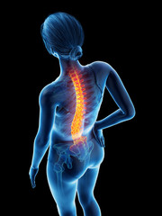 3d rendered medically accurate illustration of a woman having backache