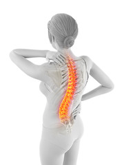 3d rendered medically accurate illustration of a woman having a backache