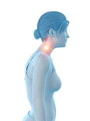 3d rendered medically accurate illustration of a woman having a painful neck