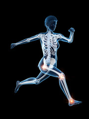 3d rendered medically accurate illustration of a woman having painful joints while running