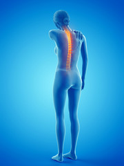 3d rendered medically accurate illustration of a woman having a backache