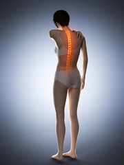 3d rendered medically accurate illustration of a woman having a backache