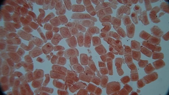 Root tip of Onion and Mitosis cell in the Root tip of Onion under a microscope.