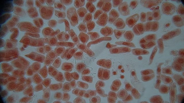 Root tip of Onion and Mitosis cell in the Root tip of Onion under a microscope.