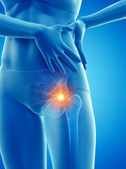 3d rendered medically accurate illustration of a woman having a painful hip