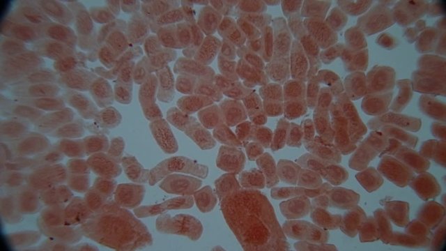 Root tip of Onion and Mitosis cell in the Root tip of Onion under a microscope.
