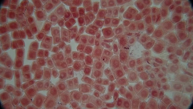 Root tip of Onion and Mitosis cell in the Root tip of Onion under a microscope.