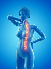 3d rendered medically accurate illustration of a woman having a painful back