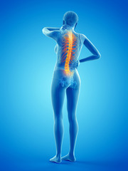 3d rendered medically accurate illustration of a woman having a backache