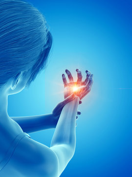 3d Rendered Medically Accurate Illustration Of A Woman Having A Painful Hand