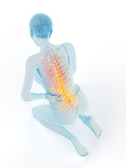 3d rendered medically accurate illustration of a woman having a painful back