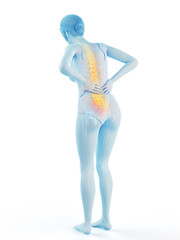 3d rendered medically accurate illustration of a woman having a painful back