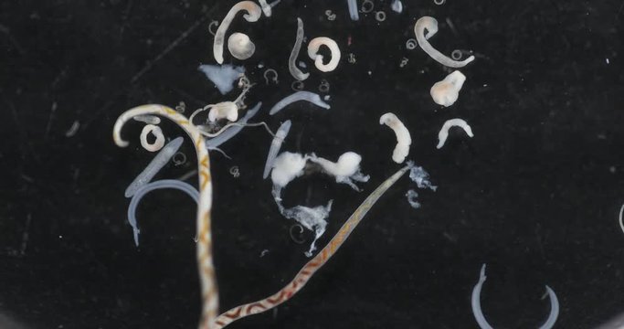 Schistosoma is a genus of trematodes, commonly known as blood flukes for study under a microscope in lab.