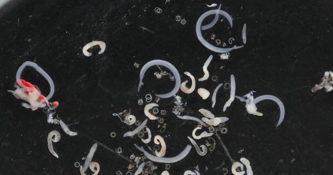 Schistosoma is a genus of trematodes, commonly known as blood flukes for study under a microscope in lab.