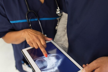 Close up doctors examining digital x-ray on digital tablet in hospital
