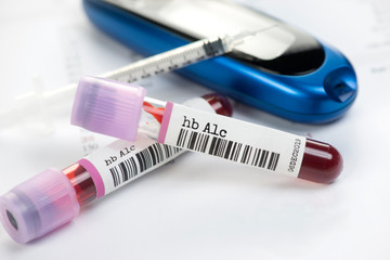 Obraz premium hBA1c Blood Test Tubes
