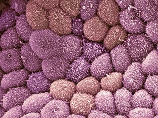 Gall bladder surface, SEM