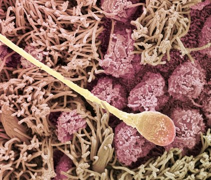 Sperm cell, SEM