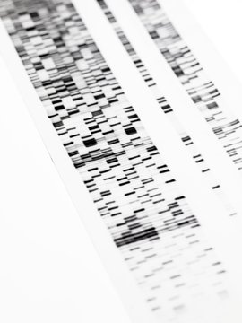 DNA autoradiogram