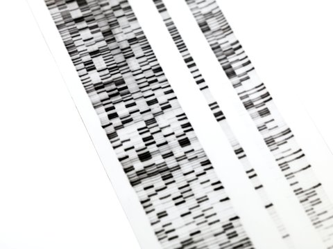 DNA autoradiogram
