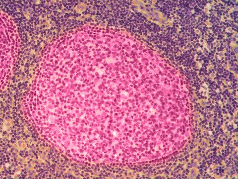 Lymph node, light micrograph