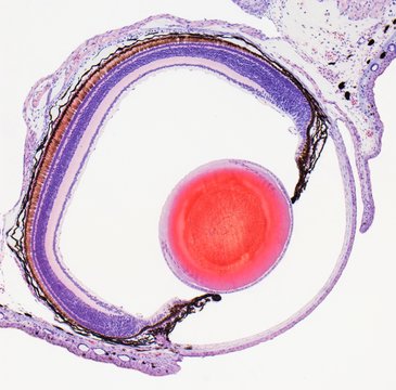 Frog eye, light micrograph