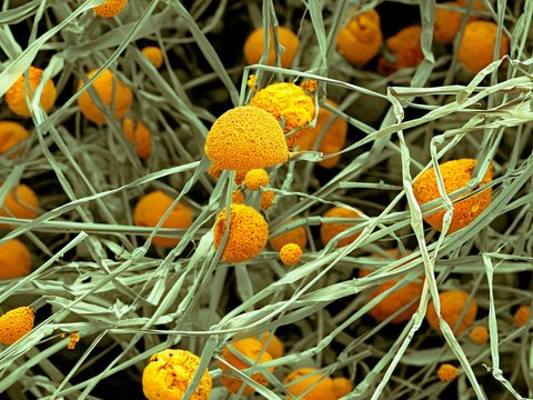 Fungal cells, SEM