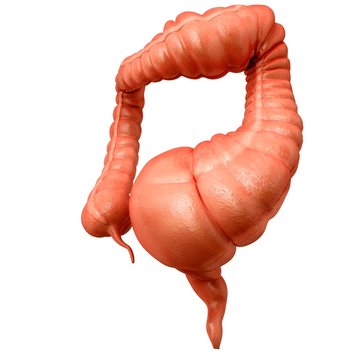 Megacolon, illustration