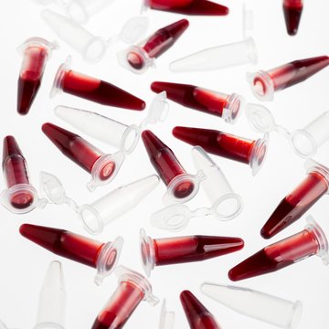 Blood samples