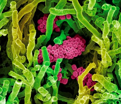 Streptomyces coelicoflavus bacteria, SEM