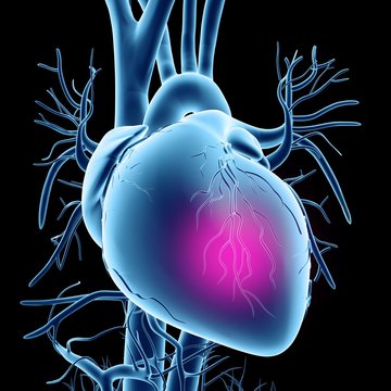 Heart attack, conceptual artwork