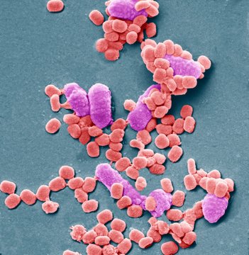 Virus particles and bacteria, SEM