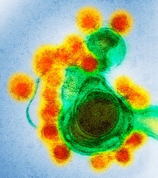 Zika virus particles, TEM