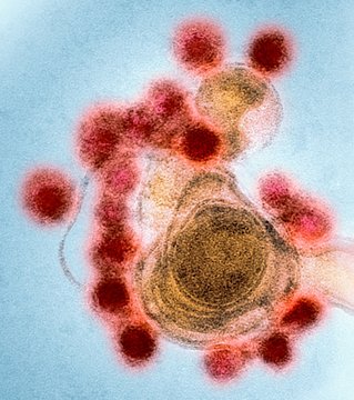 Zika virus particles, TEM