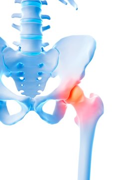 Human Hip Pain