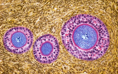 Ovarian follicles, LM