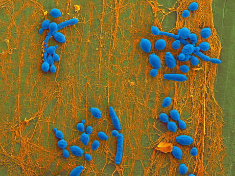 Candida Infected Medical Catheter, SEM