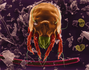 Dust mite, SEM