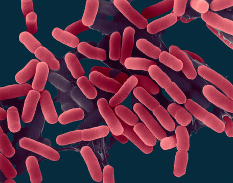 E. coli, bacterium, SEM