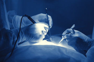 Hands of the surgeon.