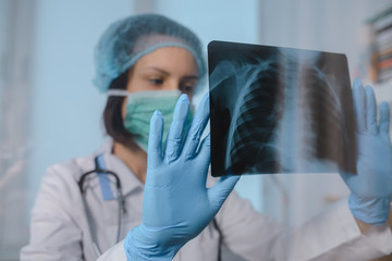 Young  female doctor analyse  chest x-ray radiography in clinic