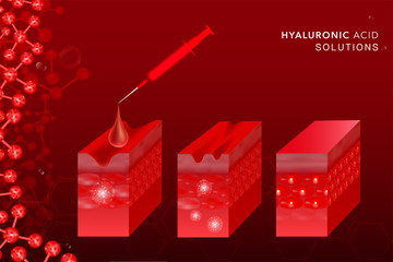 Hyaluronic acid before and after skin solutions ad, red collagen serum drop with cosmetic advertising background ready to use, illustration vector.