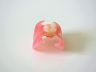 Removable denture type Butterfly on a light background. Replacement of one missing tooth. Closeup.