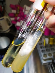 Tubos laboratorio positivos hongo filamentoso