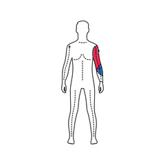 Man with artificial hand color line icon. Person who has a prosthesis instead of a real hand. Pictogram for web page, mobile app, promo. UI UX GUI design element. Editable stroke.