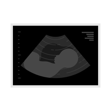 Baby ultrasound picture flat icon. Fetus silhouette in mothers womb, pregnancy diagnostic sonography or ultrasonography concept isolated on white background. Vector illustration