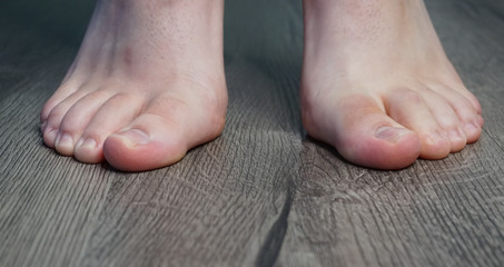 Foot Feet Healthy Feet Barefoot