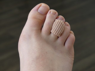 Chiropody Podiatry Medical Foot Care