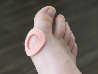Chiropody Podiatry Medical Foot Care